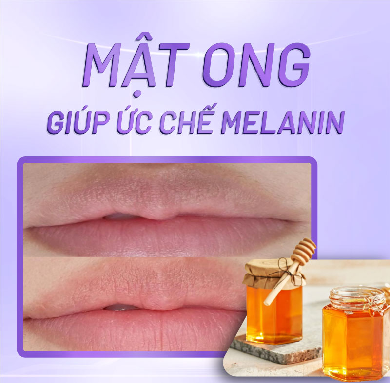 cách trị môi thâm bẩm sinh tại nhà