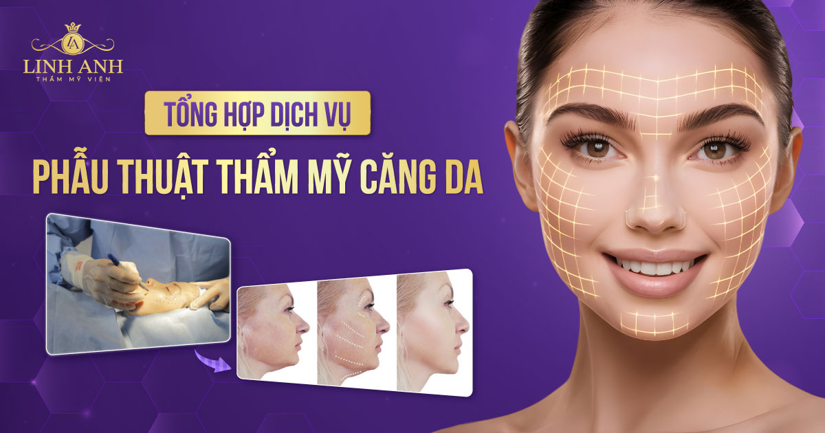 căng da - Viện thẩm mỹ quốc tế Linh Anh