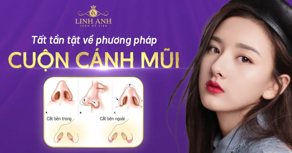 cắt cánh mũi - Viện thẩm mỹ quốc tế Linh Anh