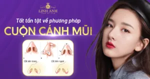 cắt cánh mũi - Viện thẩm mỹ quốc tế Linh Anh