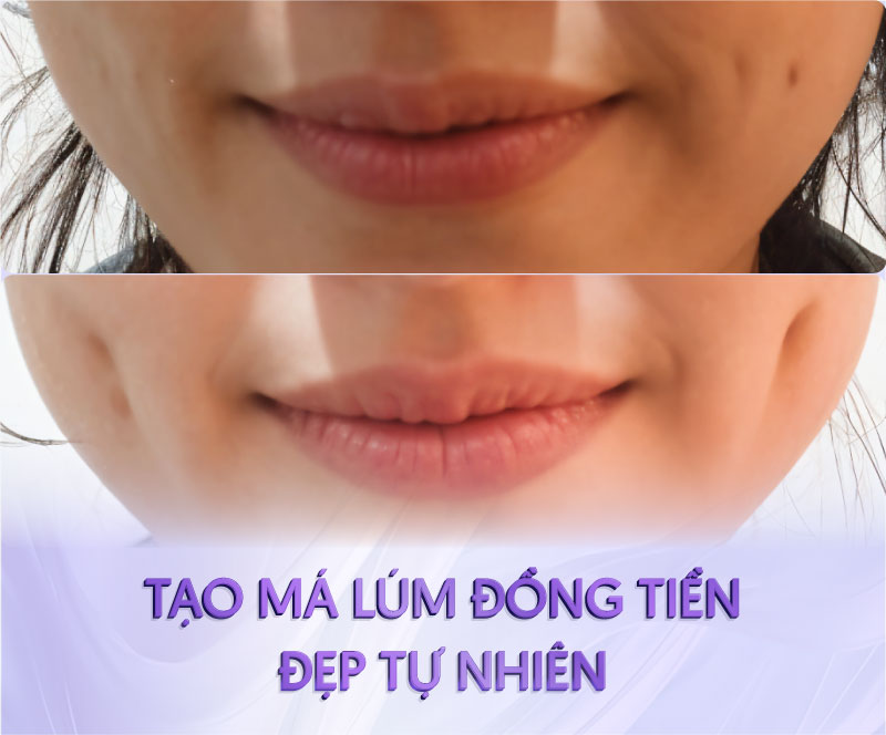 cắt đồng tiền