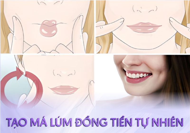 cắt má lúm đồng tiền