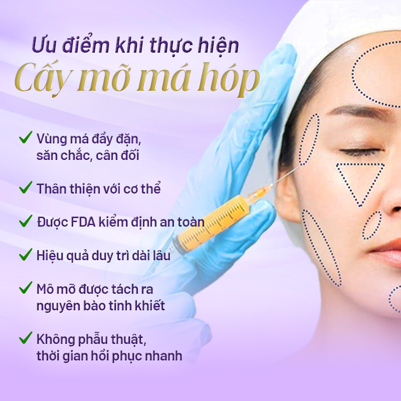 cấy mỡ má hóp là sao