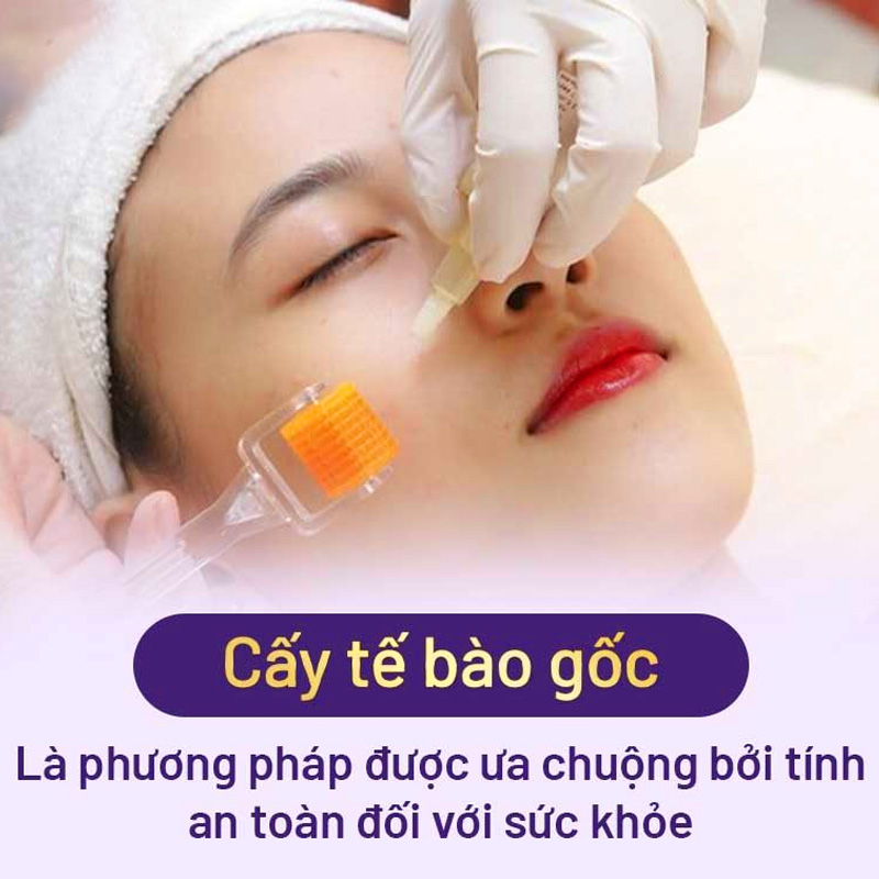 cấy tế bào gốc cho da mặt có mắc không