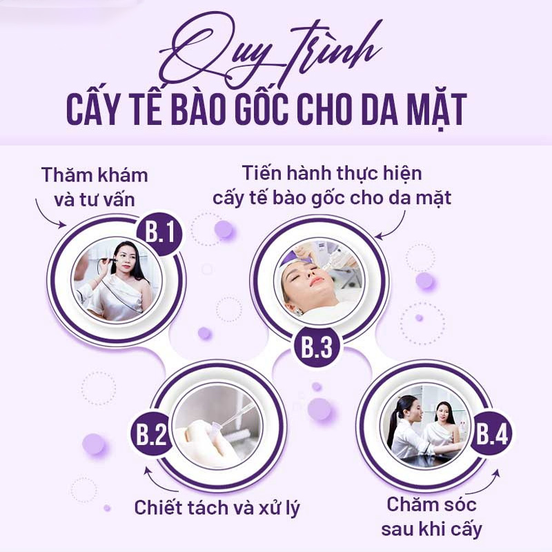 chi phí cấy tế bào gốc