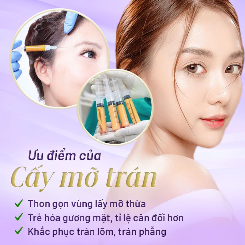 có nên cấy mỡ trán