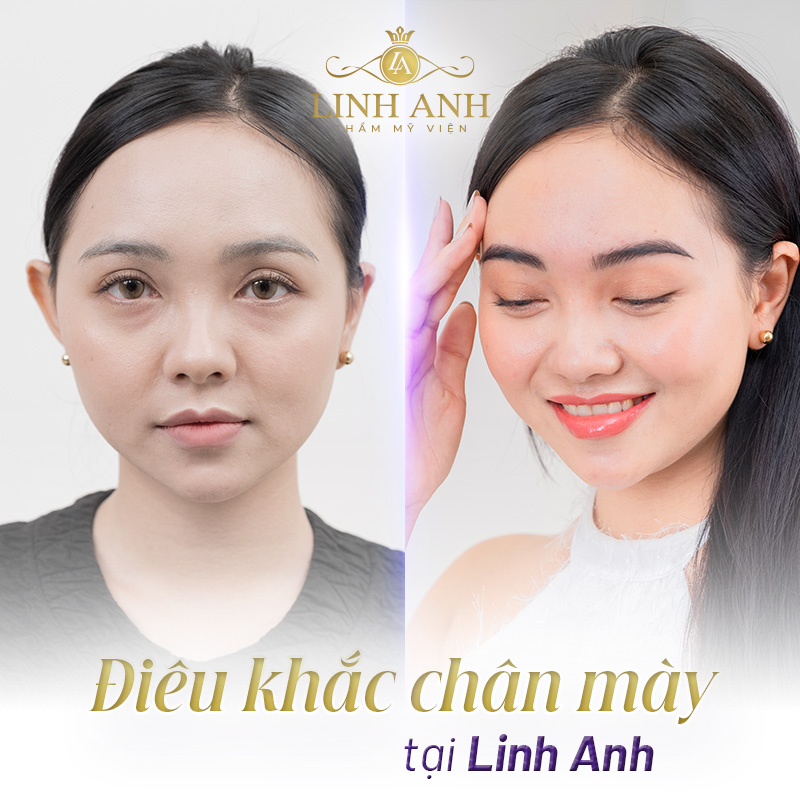 cung mệnh người có tướng lông mày rồng - Viện thẩm mỹ quốc tế Linh Anh