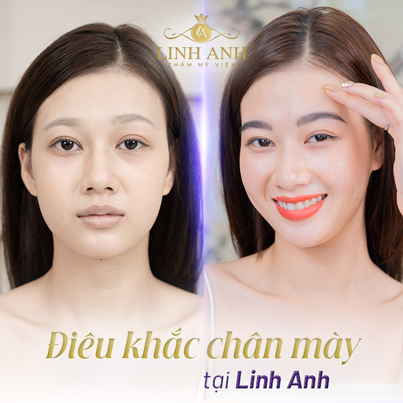 dáng chân mày rồng - Viện thẩm mỹ quốc tế Linh Anh