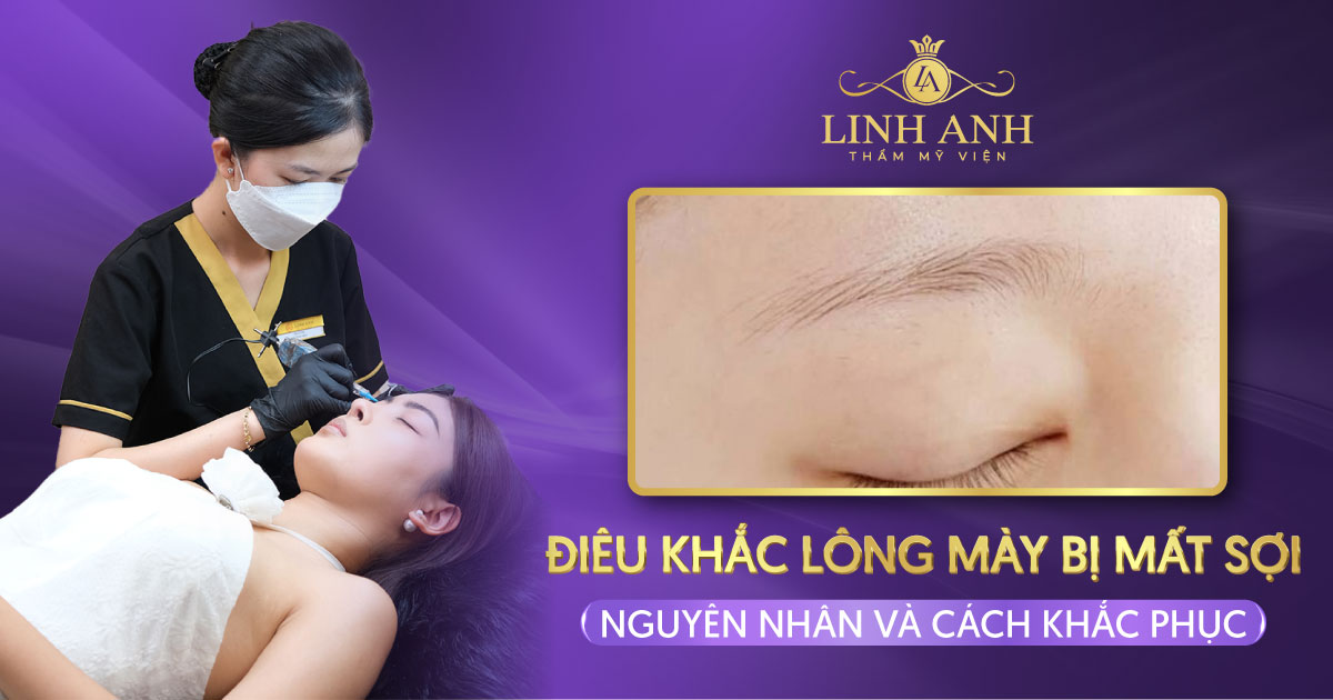 điêu khắc lông mày bị mất sợi