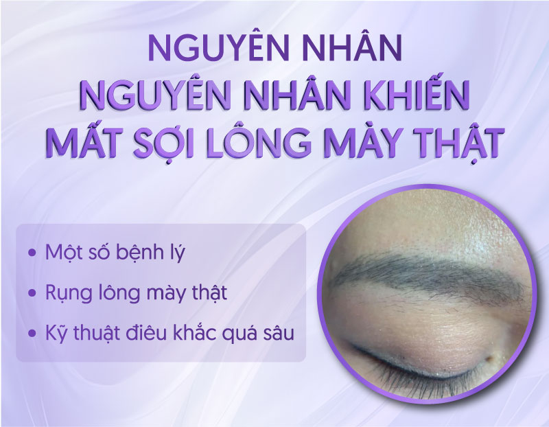 điêu khắc lông mày sau khi bong bị mất sợi