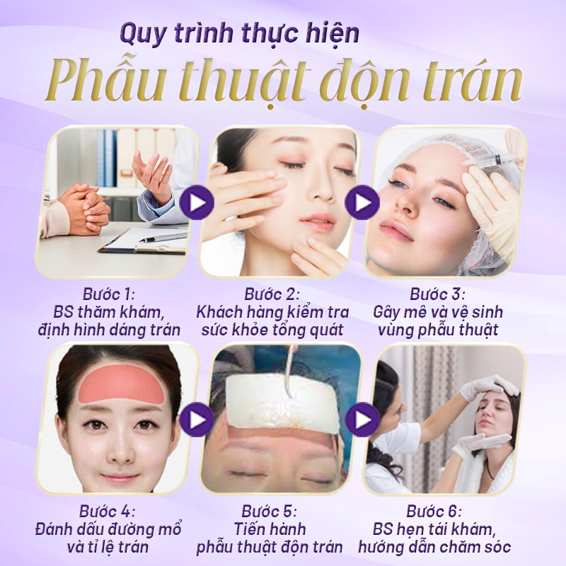 độn trán có an toàn không