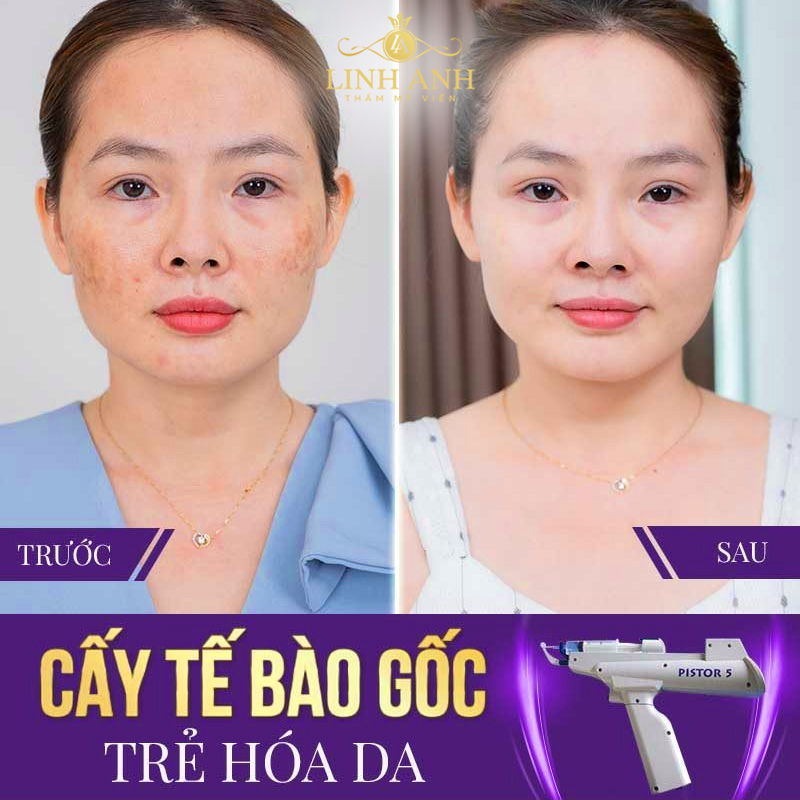 giá cấy tế bào gốc