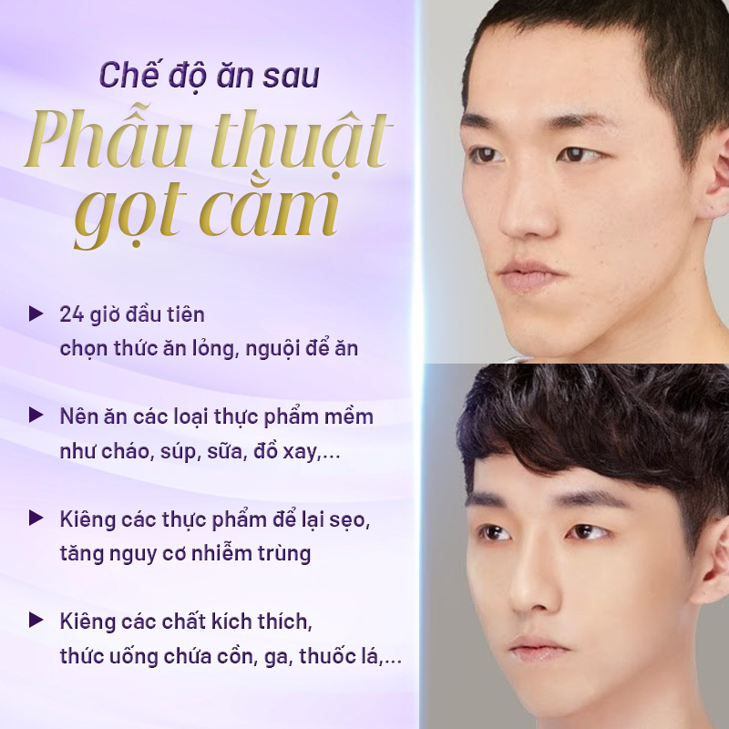 gọt hàm nam