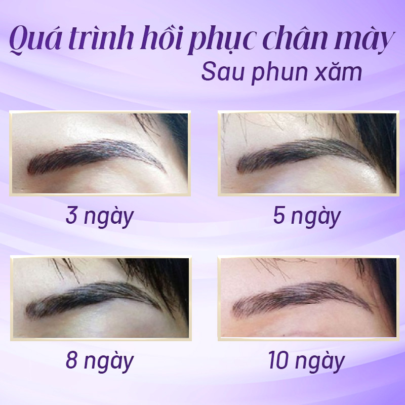 khắc phục phun lông mày bị to quá