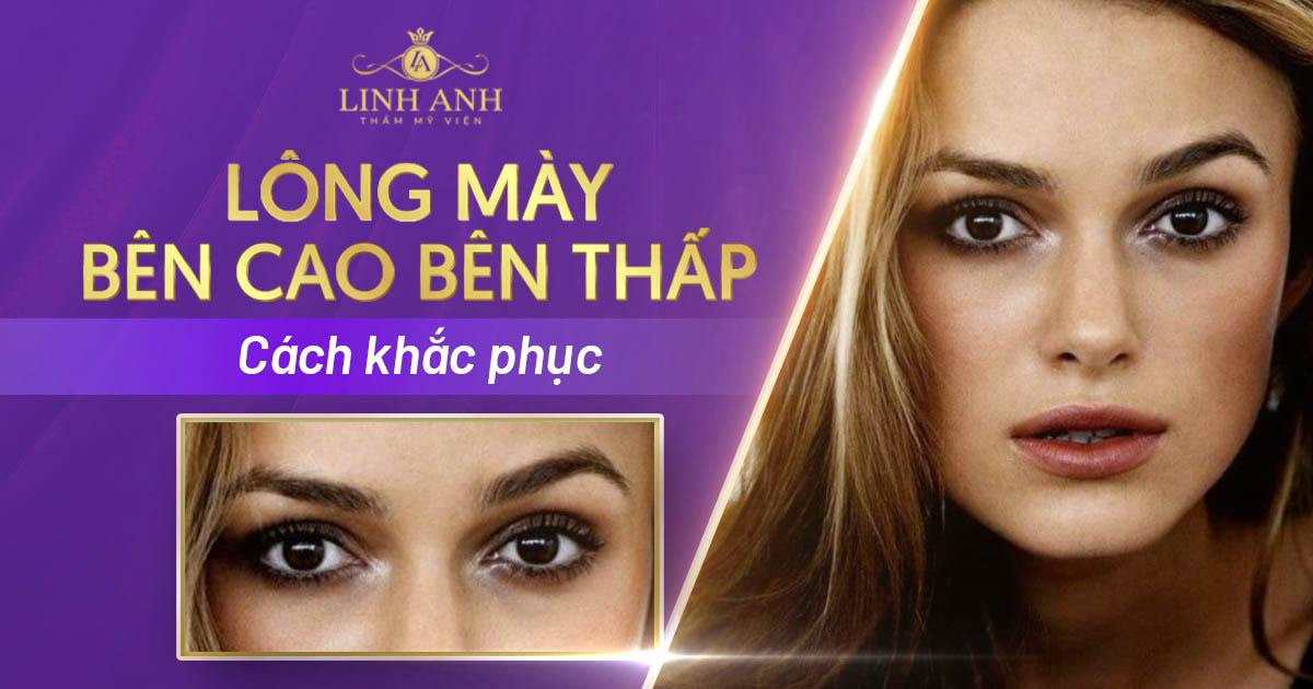 lông mày bên cao bên thấp