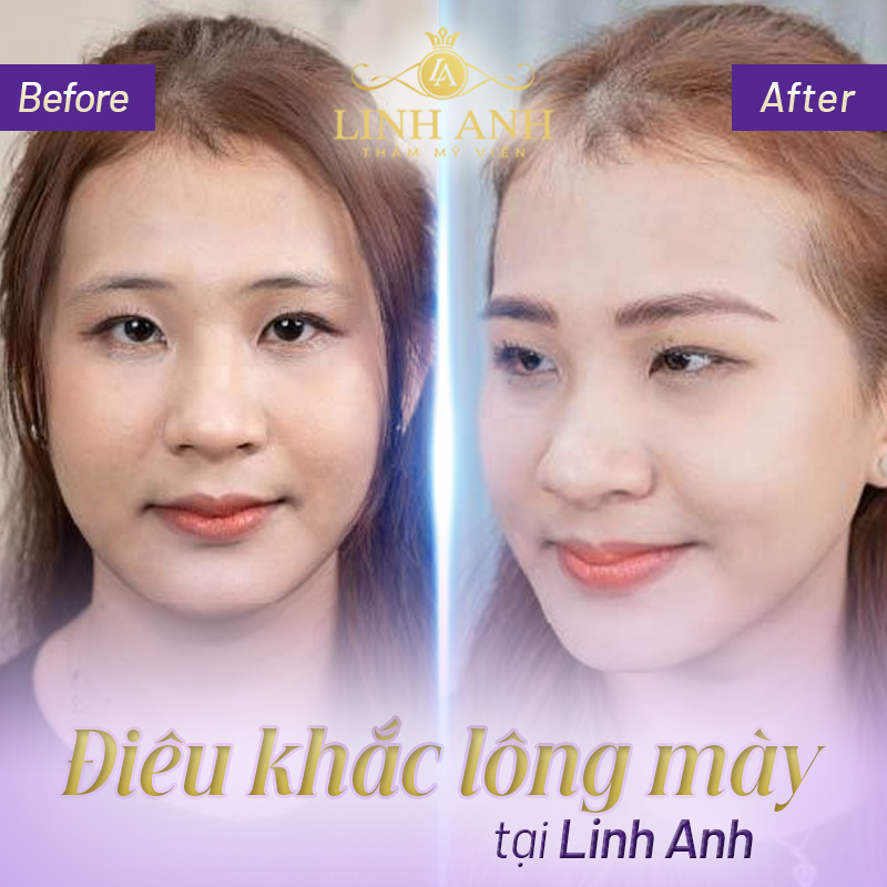 Lông mày đầu đậm đuôi nhạt nói lên điều gì - Viện thẩm mỹ quốc tế Linh Anh