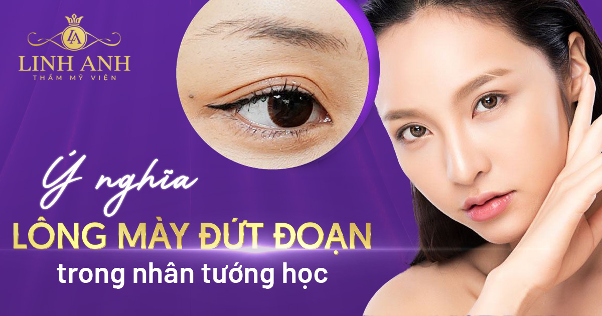 lông mày đứt đoạn