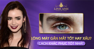 lông mày gần mắt