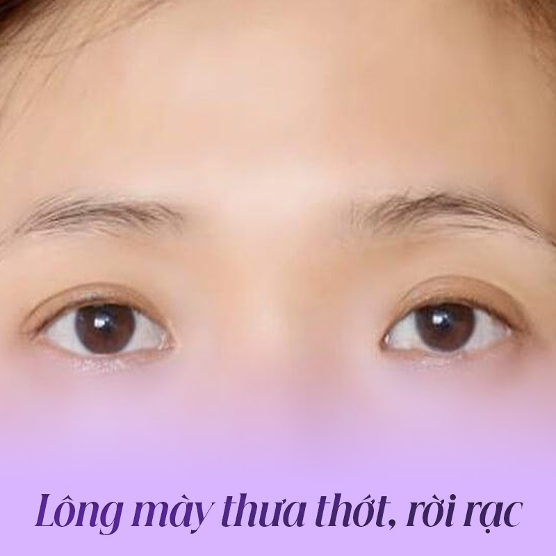 lông mày thưa mỏng