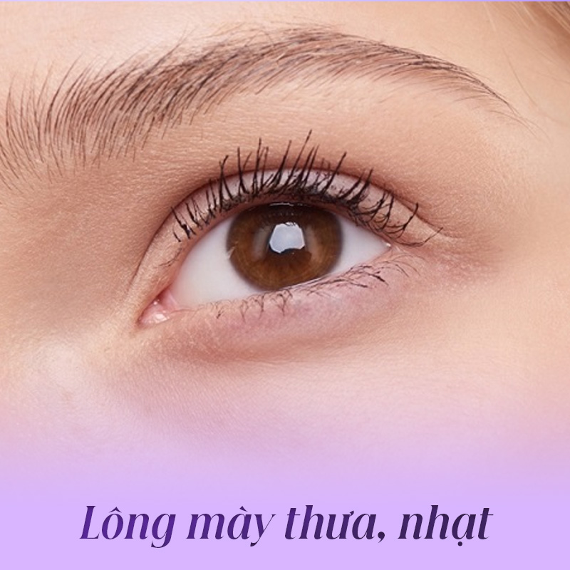 lông mày thưa nam nữ - Viện thẩm mỹ quốc tế Linh Anh