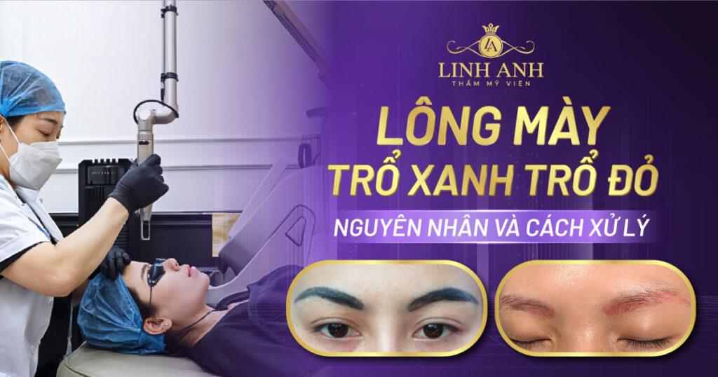 lông mày trổ xanh trổ đỏ