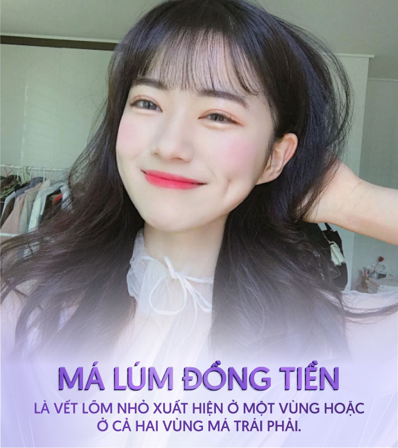 má lúm đồng tiền