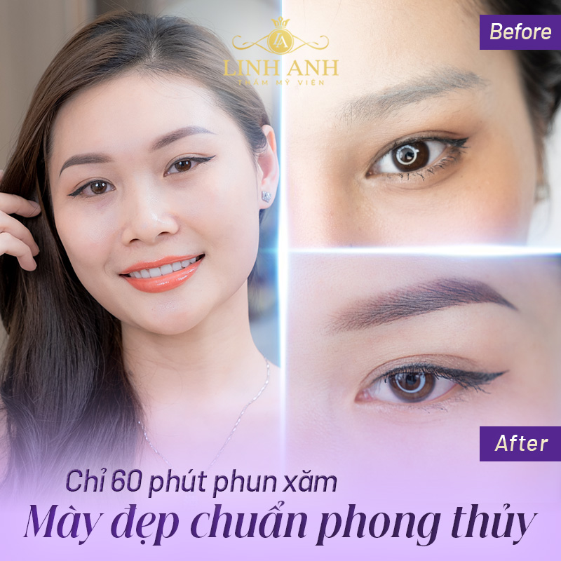 mẫu mày đẹp - Viện thẩm mỹ quốc tế Linh Anh