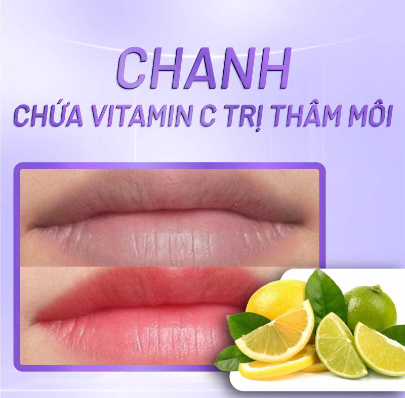 môi thâm bẩm sinh có hết không