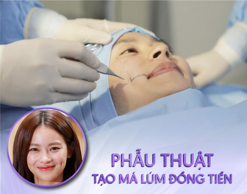 nhấn má lúm đồng tiền