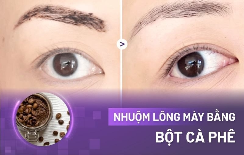 Nhuộm lông mày có nên không - Viện thẩm mỹ quốc tế Linh Anh