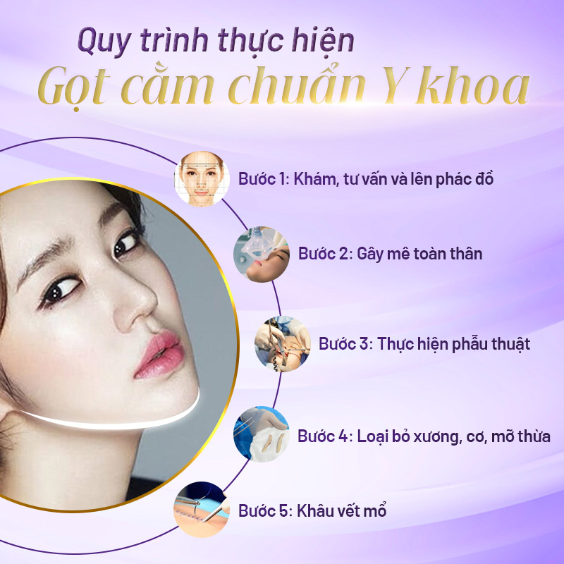 phẫu thuật gọt cằm