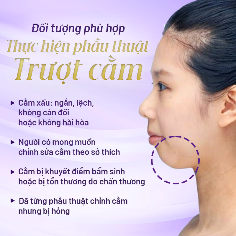 phẫu thuật trượt cằm