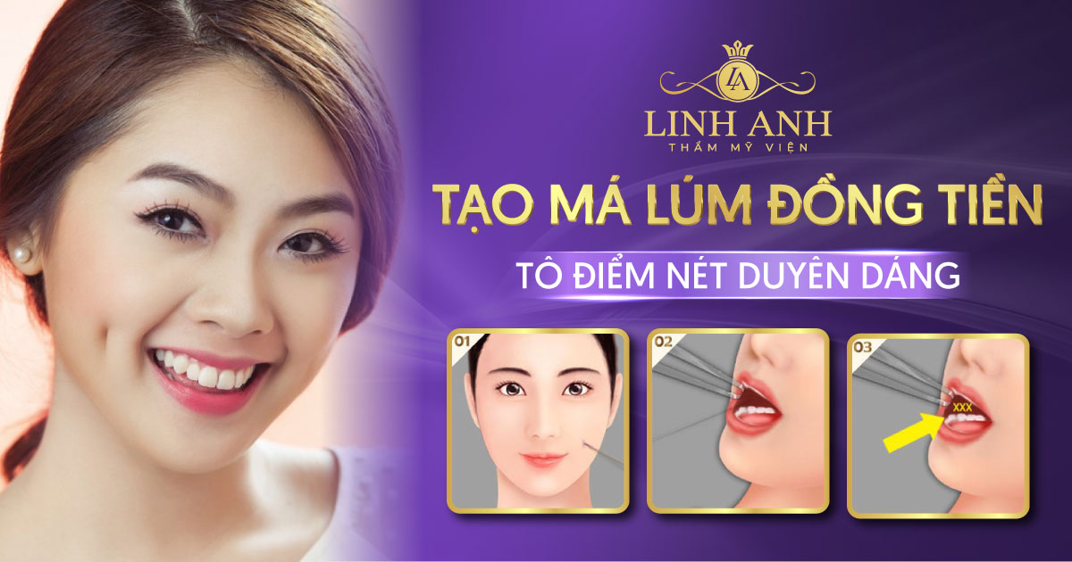 Tạo má lúm đồng tiền tô điểm nét duyên dáng thêm xinh