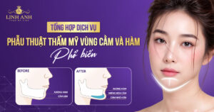 thẩm mỹ vùng cằm và hàm