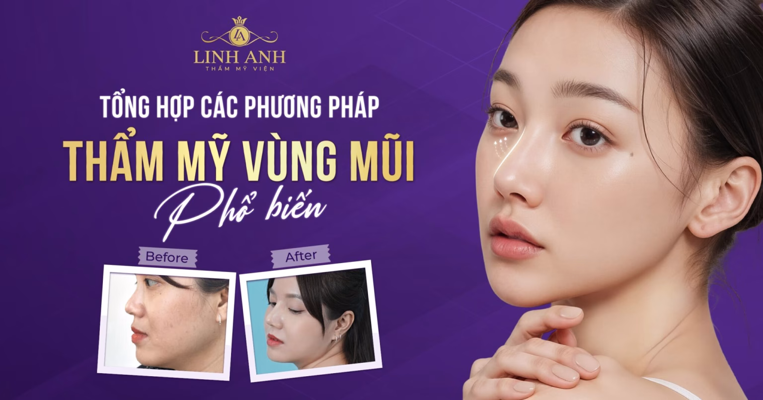 thẩm mỹ mũi - Viện thẩm mỹ quốc tế Linh Anh