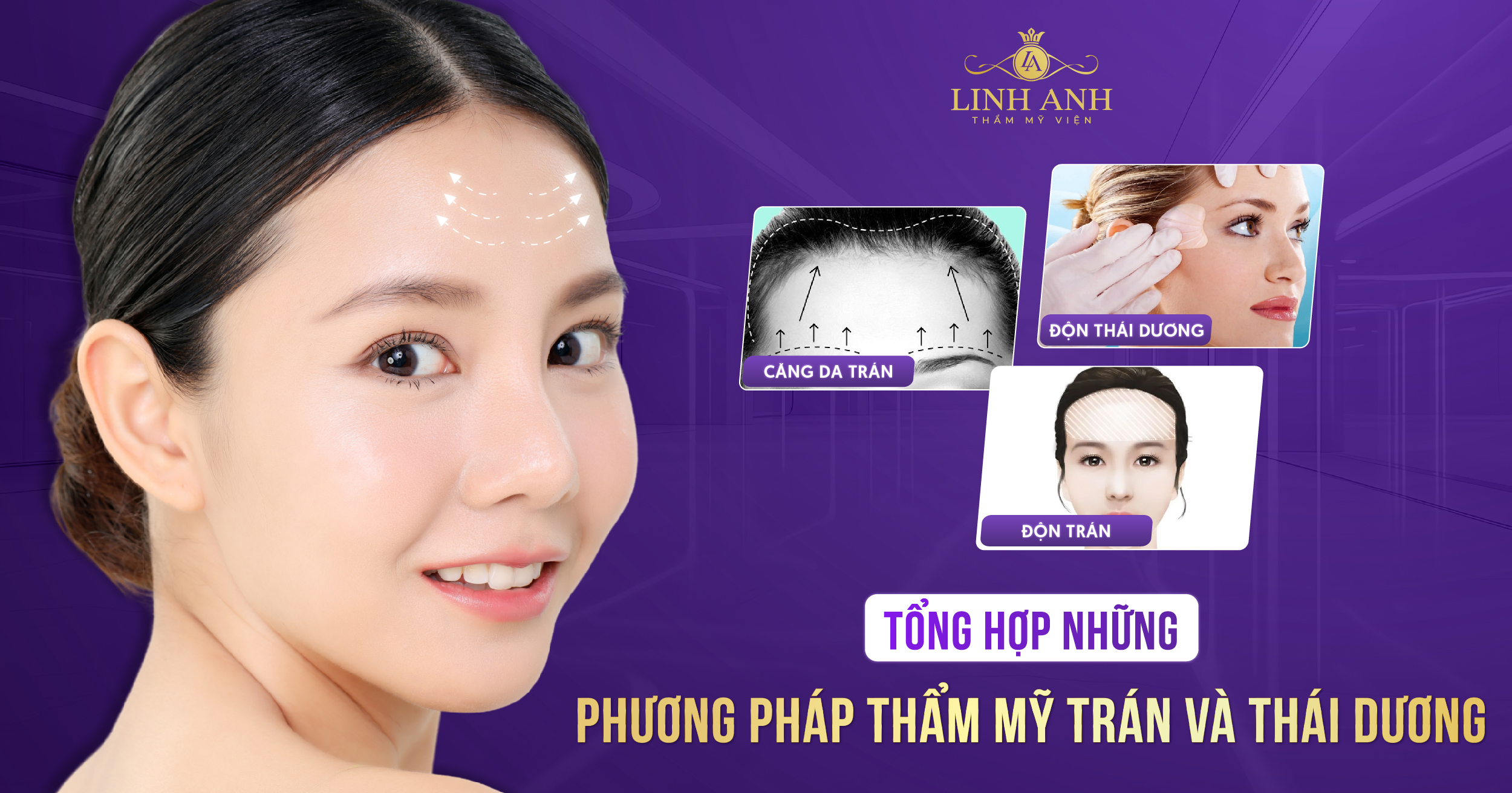 thẩm mỹ trán và thái dương