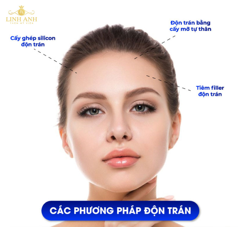 thẩm mỹ vùng thái dương