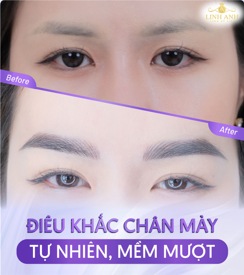 thuốc mọc lông mày an toàn