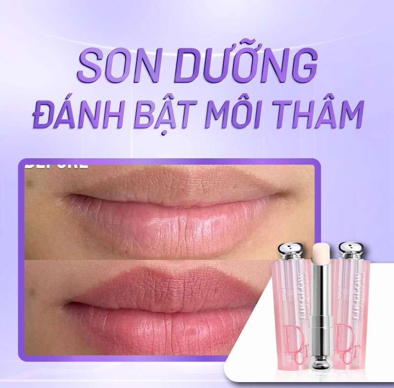 trị thâm môi bẩm sinh