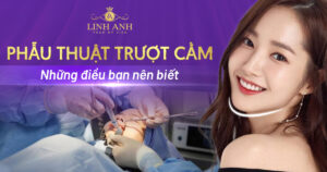 trượt cằm