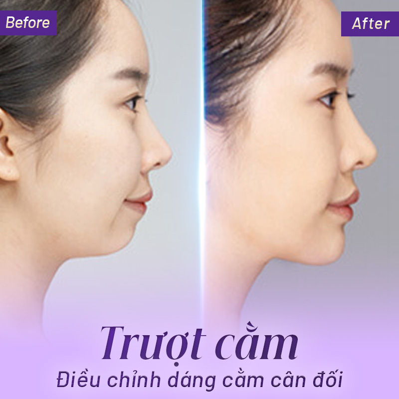 trượt cằm ở đâu tốt