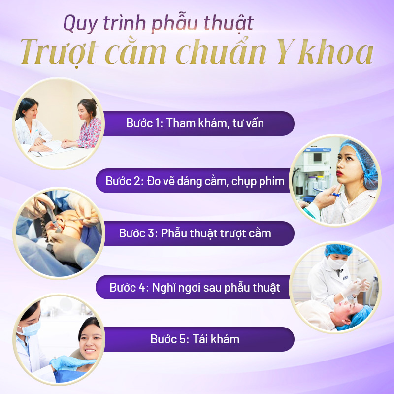 trượt cằm ở đâu uy tín