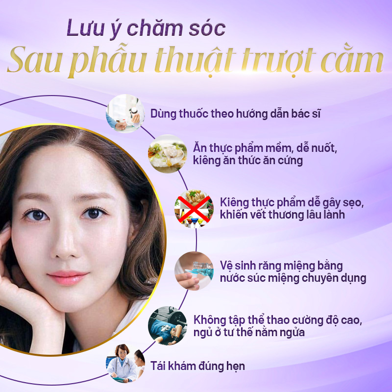 trượt cằm vĩnh viễn