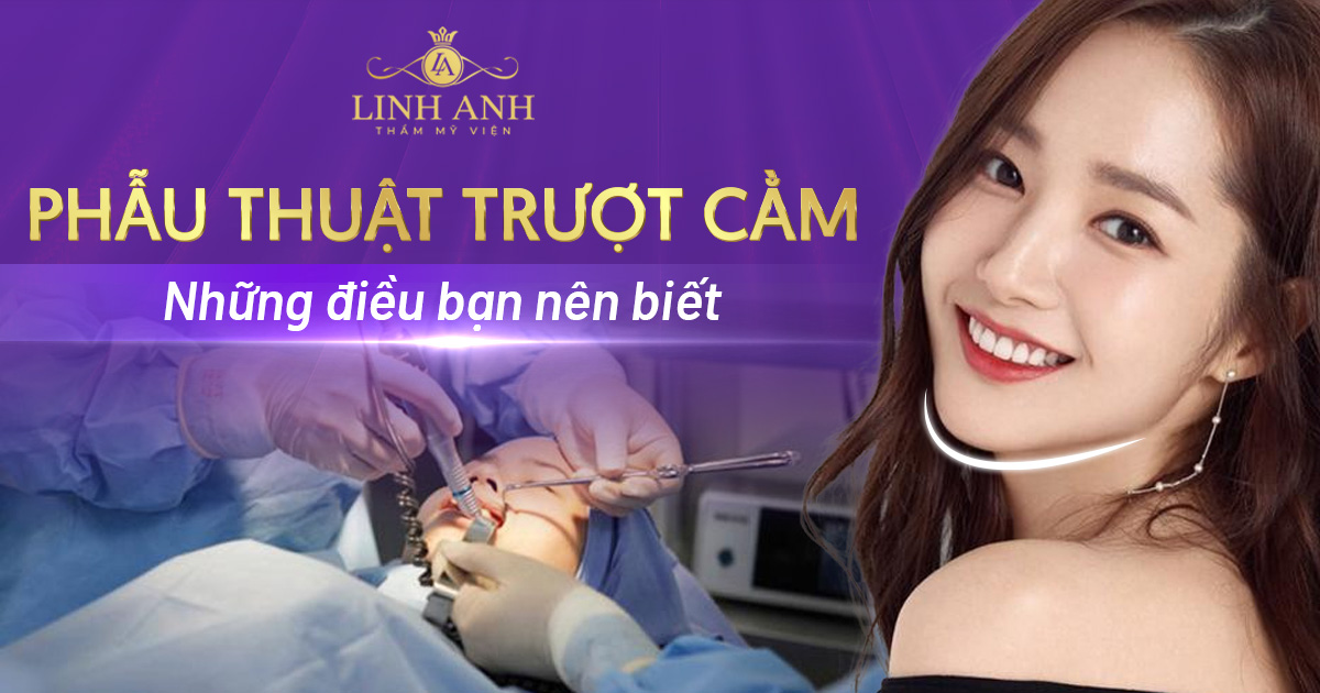 Phẫu thuật trượt cằm – Quy trình thực hiện và những lưu ý cần nắm