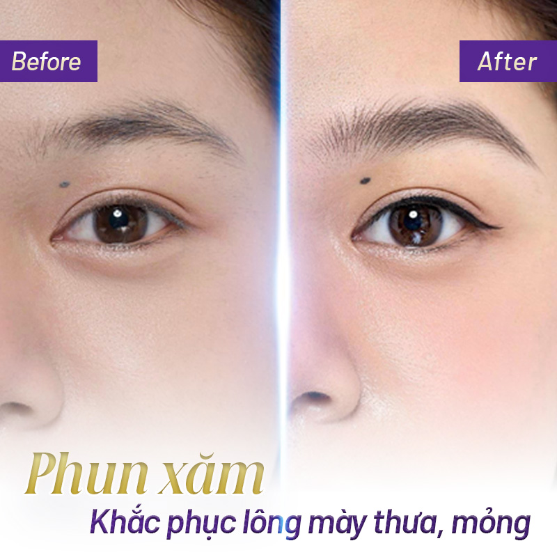 tướng lông mày thưa nhạt - Viện thẩm mỹ quốc tế Linh Anh