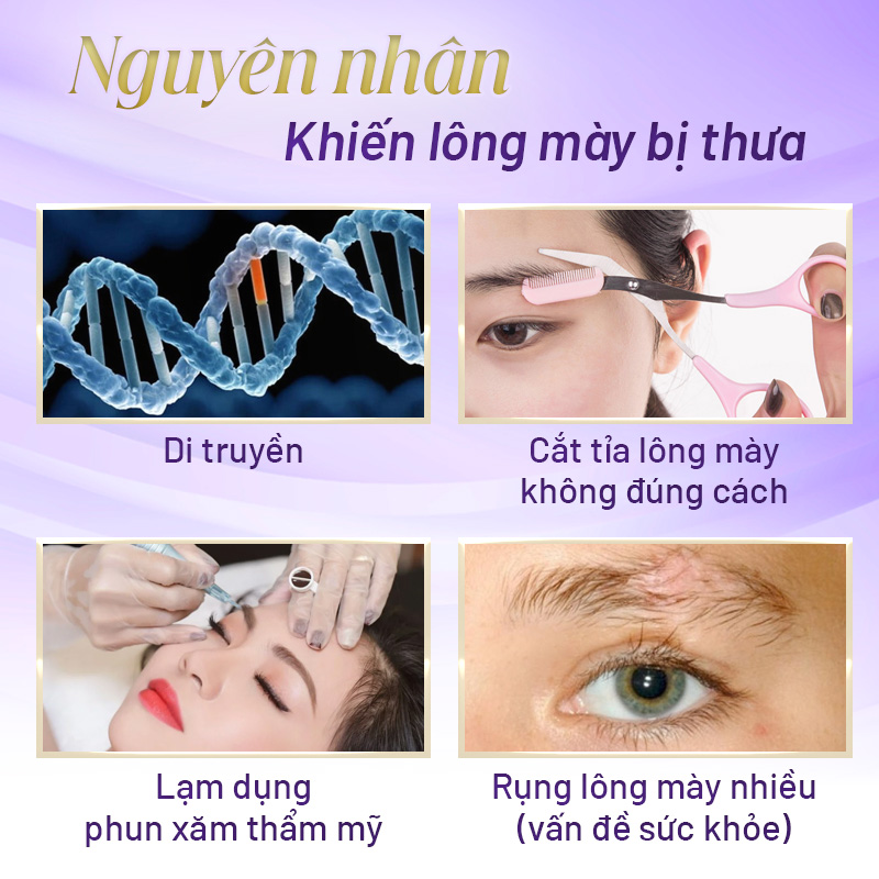 tướng lông mày thưa - Viện thẩm mỹ quốc tế Linh Anh