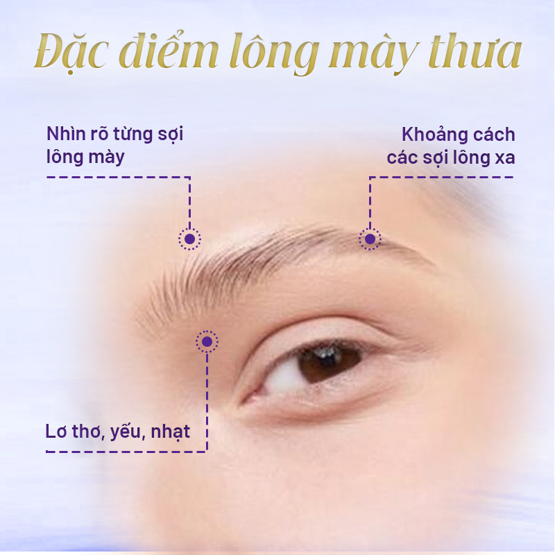 tướng số người có lông mày thưa - Viện thẩm mỹ quốc tế Linh Anh