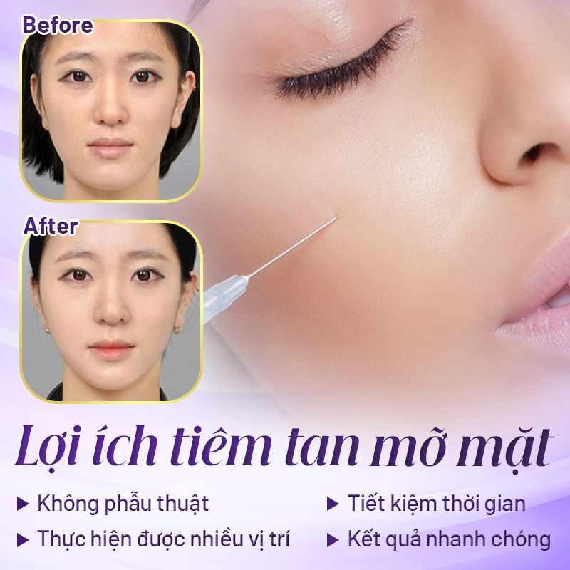 giá tiêm tan mỡ mặt