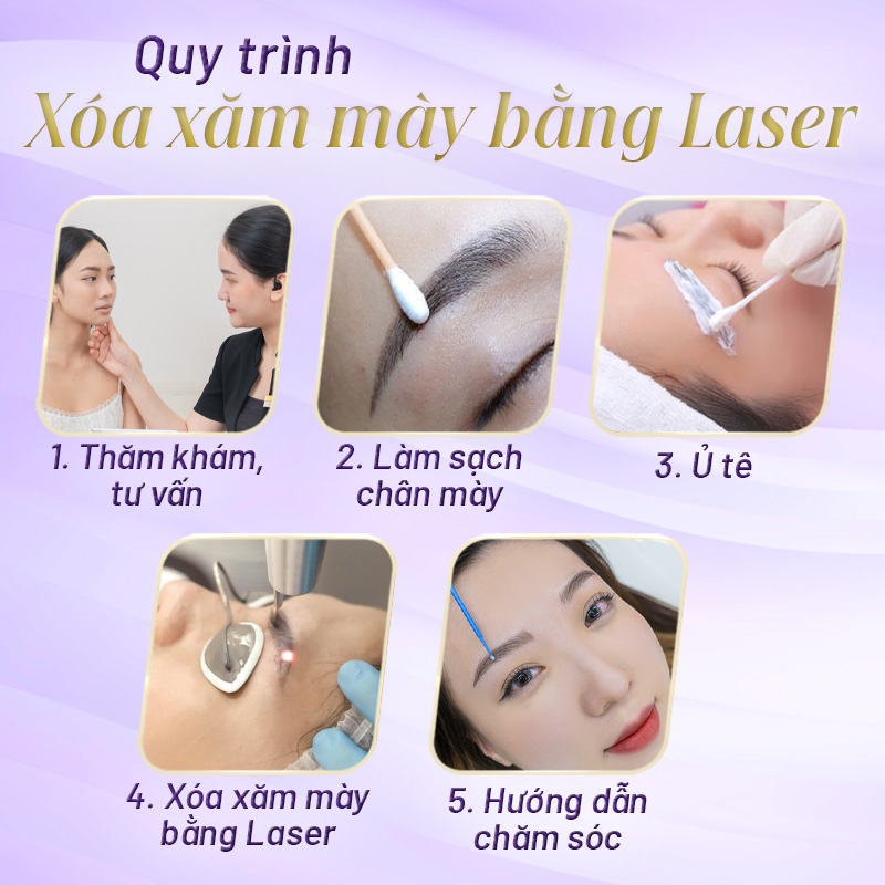 Xóa chân mày bằng laser