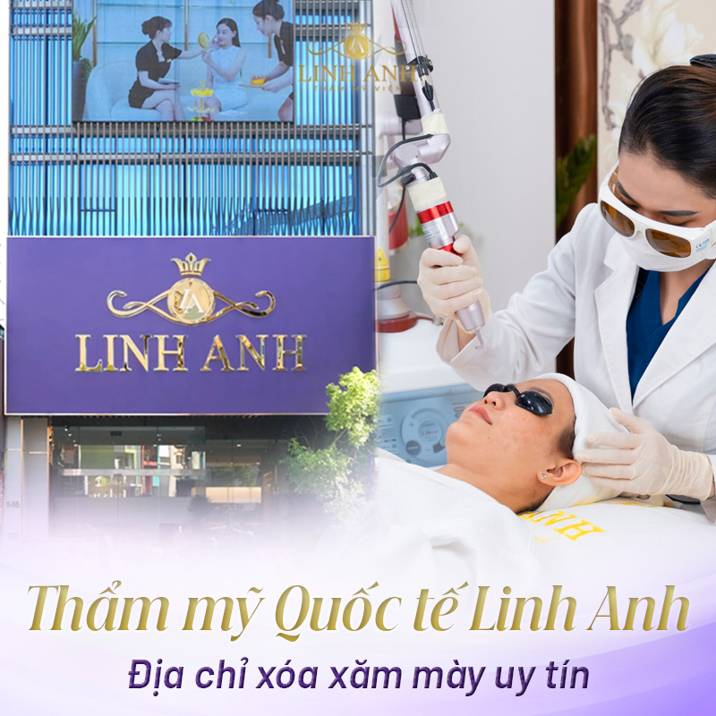 Xoá chân mày laser